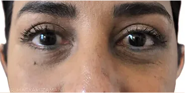 Close-up of a person's eyes with natural makeup and dark eyelashes.