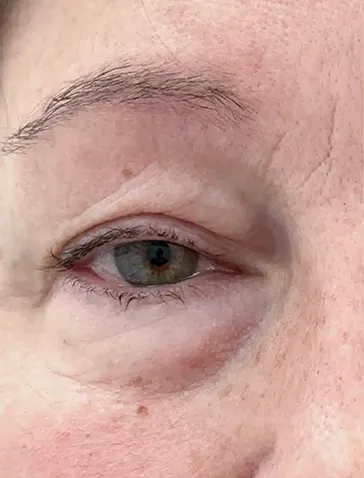 Close-up of a human eye with natural skin texture and some wrinkles around it.