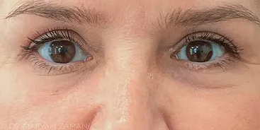 Close-up of a person's brown eyes and eyebrows.