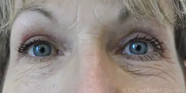 Close-up of a person's blue eyes with visible eyelashes and light wrinkles around the eye area.