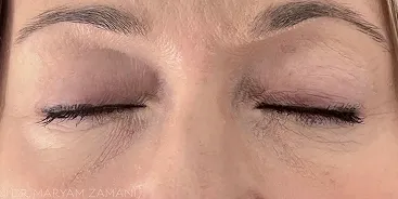 Close-up of a person's closed eyes showing natural upper eyelids and eyelashes.