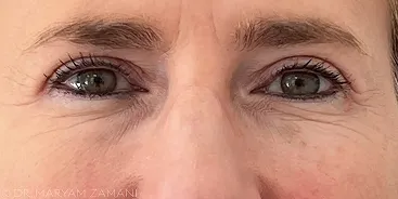 Close-up of a person's eyes with light green irises and surrounding facial wrinkles.