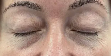 Close-up of closed eyes showing upper eyelids and natural skin texture.