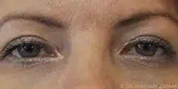 Close-up of a person's eyes with natural makeup and well-defined eyebrows.