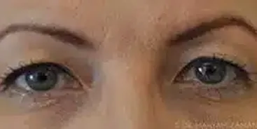 Close-up of a person's eyes showing natural skin texture and light eyebrow makeup.