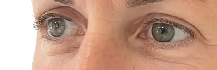 Close-up of a person's green eyes and upper facial area showing natural skin texture and eyelashes.