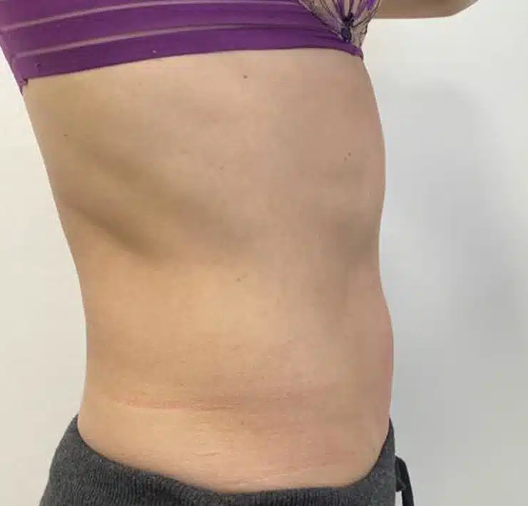 Side view of a person's midsection showing a flat abdomen wearing a purple top and dark pants.