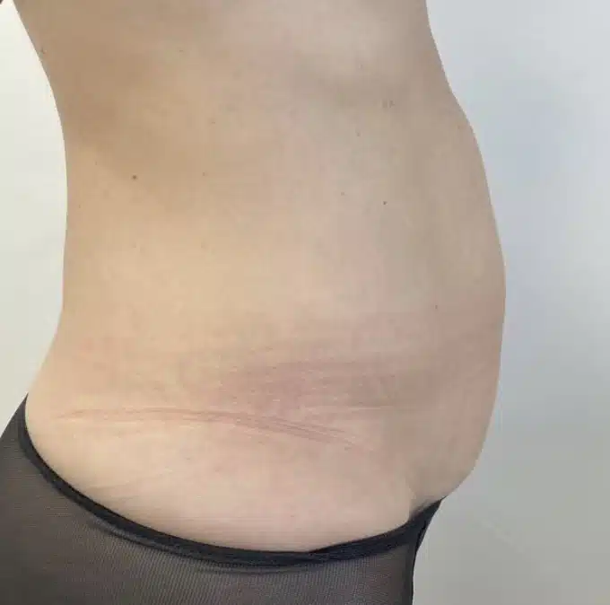 Close-up side view of a person's bare midsection and lower abdomen wearing black mesh underwear against a neutral background.