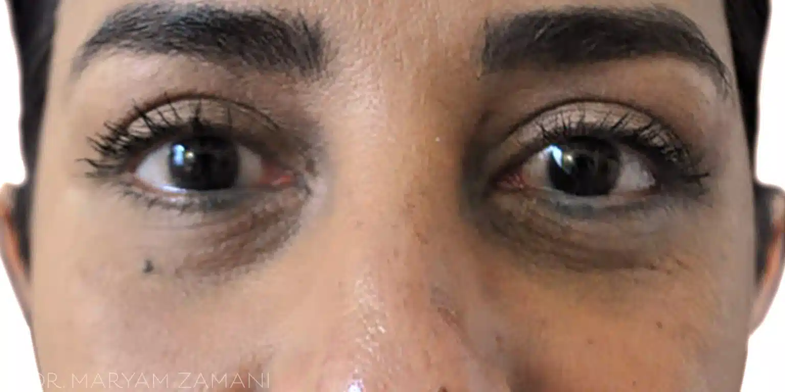 Close-up of a person's eyes with long eyelashes and dark eyebrows.