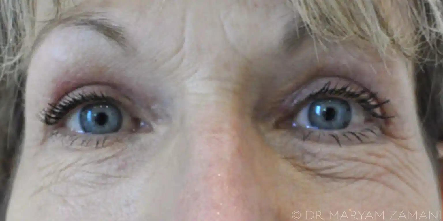 Close-up of a woman's blue eyes with visible eyelashes and fine wrinkles around the eyes.