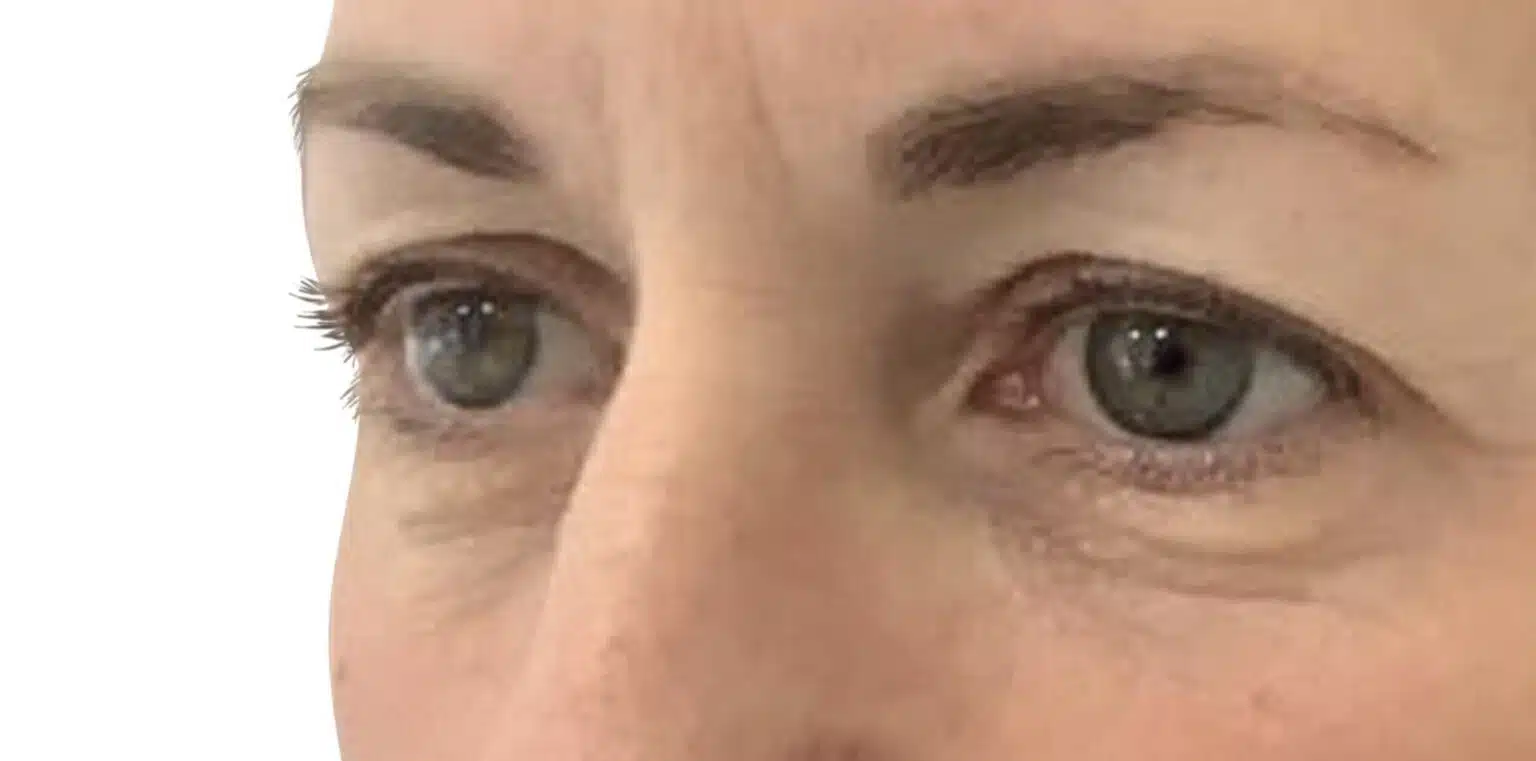 Close-up of a person's green eyes, eyebrows, and upper nose area with visible skin texture and wrinkles.