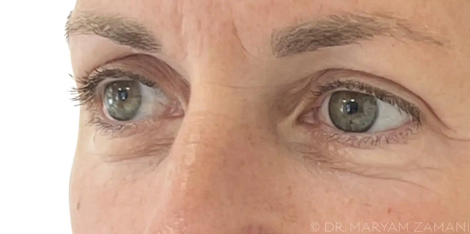 Close-up of a person's green eyes and eyebrows with visible skin texture around the eyes.