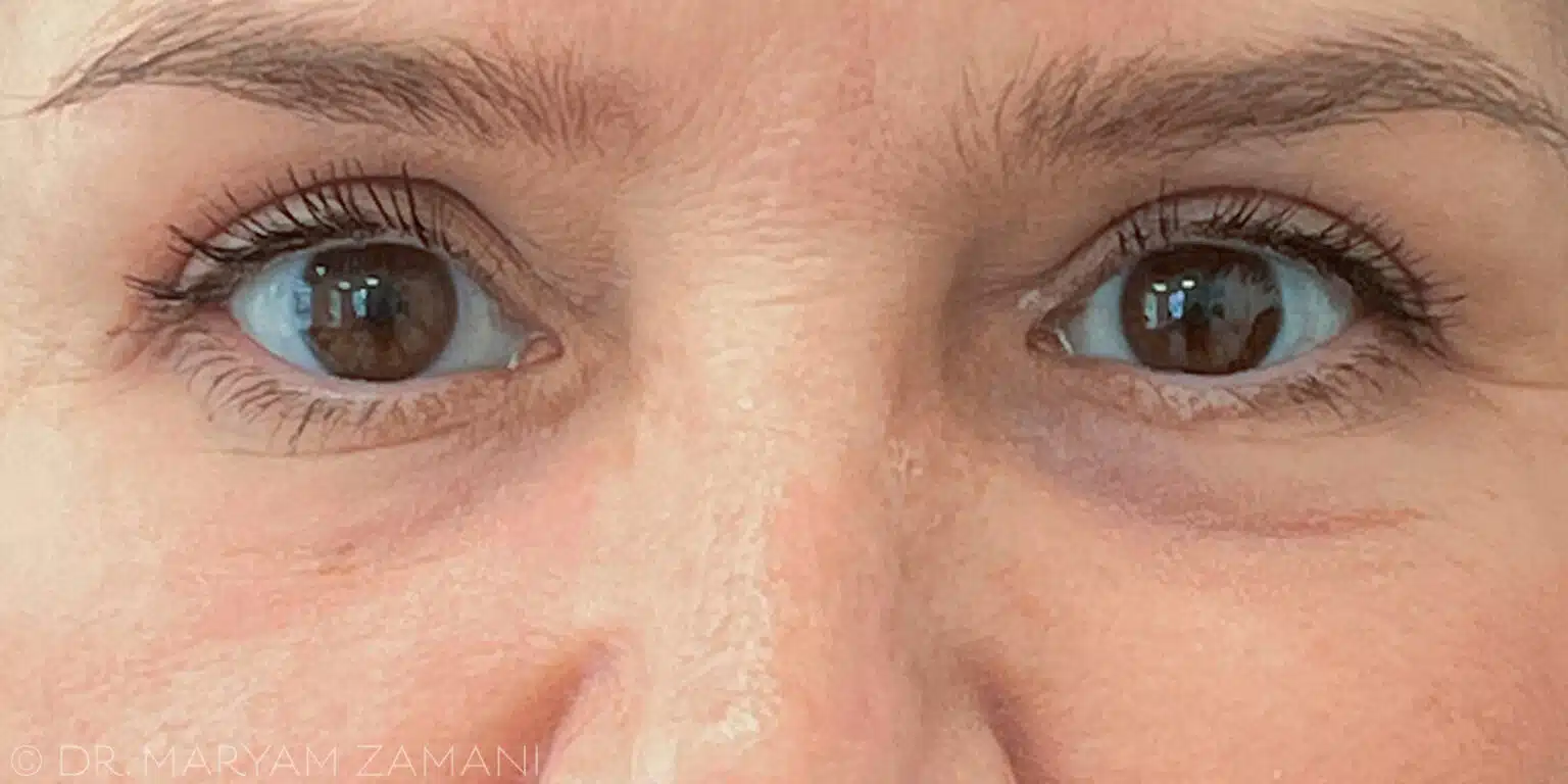 Close-up of a person's eyes with brown irises and natural eyelashes.