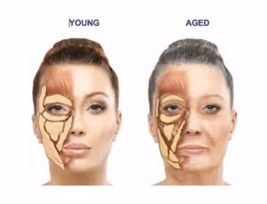 Comparison of young and aged female faces showing skin and underlying facial muscles.