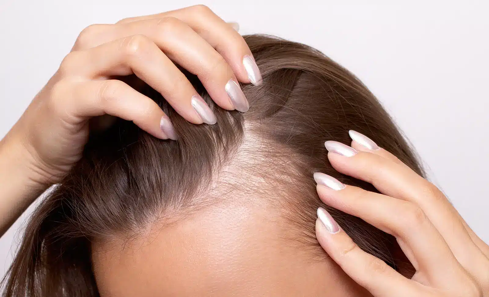 Close-up of hands parting a woman’s brown hair to reveal thinning hair and scalp on top.
