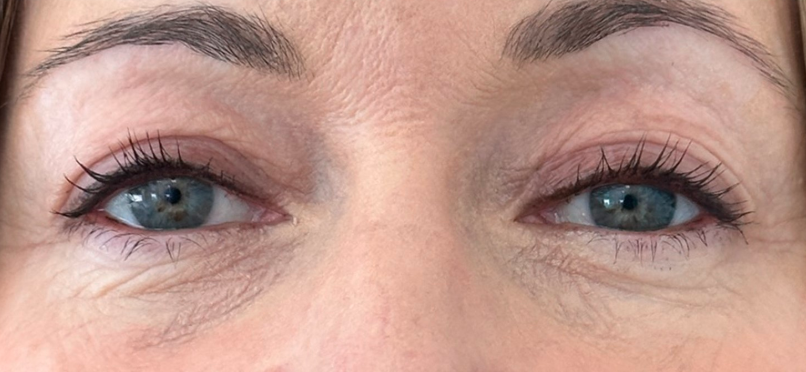 Close-up of a person's blue eyes with natural eyelashes and eyebrows, showing wrinkles around the eye area.