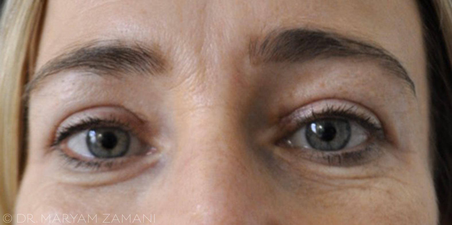 Close-up of a woman's face showing eyes with gray-blue irises and natural eyebrows.