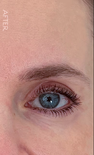 Close-up of a blue eye with long lashes and well-groomed eyebrow labeled 'After'.