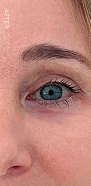 Close-up of the right side of a woman's face showing smooth skin and a blue eye with long eyelashes.